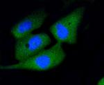 Active Caspase 3 Antibody in Immunocytochemistry (ICC/IF)