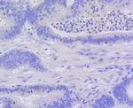 Active Caspase 3 Antibody in Immunohistochemistry (Paraffin) (IHC (P))