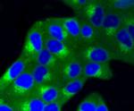 IGF2R Antibody in Immunocytochemistry (ICC/IF)