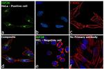 IGF2R Antibody