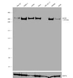 IGF2R Antibody