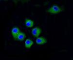 CDK2 Antibody in Immunocytochemistry (ICC/IF)