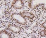 HP1 alpha Antibody in Immunohistochemistry (Paraffin) (IHC (P))