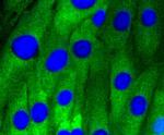 Caveolin 1 Antibody in Immunocytochemistry (ICC/IF)