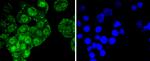 ATF2 Antibody in Immunocytochemistry (ICC/IF)