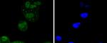 ATF2 Antibody in Immunocytochemistry (ICC/IF)