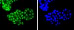 ATF2 Antibody in Immunocytochemistry (ICC/IF)