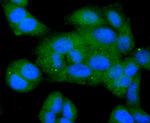 BCL-XL Antibody in Immunocytochemistry (ICC/IF)