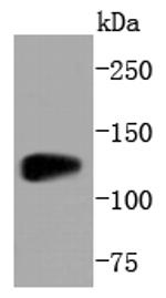 SIRT1 Antibody in Western Blot (WB)