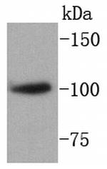 SATB1 Antibody in Western Blot (WB)