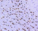 OLIG2 Antibody in Immunohistochemistry (Paraffin) (IHC (P))