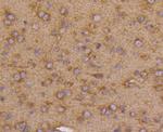 VEGF Receptor 1 Antibody in Immunohistochemistry (Paraffin) (IHC (P))