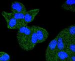 TACC3 Antibody in Immunocytochemistry (ICC/IF)