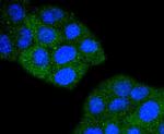 TACC3 Antibody in Immunocytochemistry (ICC/IF)