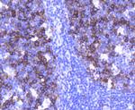 TACC3 Antibody in Immunohistochemistry (Paraffin) (IHC (P))