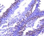 TACC3 Antibody in Immunohistochemistry (Paraffin) (IHC (P))