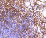 CD140b (PDGFRB) Antibody in Immunohistochemistry (Paraffin) (IHC (P))