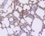 CD140b (PDGFRB) Antibody in Immunohistochemistry (Paraffin) (IHC (P))