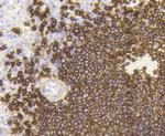 CD20 Antibody in Immunohistochemistry (Paraffin) (IHC (P))