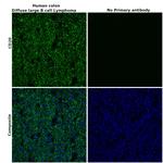 CD20 Antibody in Immunohistochemistry (Paraffin) (IHC (P))