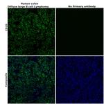 CD20 Antibody in Immunohistochemistry (Paraffin) (IHC (P))