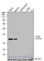 CD20 Antibody in Western Blot (WB)