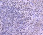 YY1 Antibody in Immunohistochemistry (Paraffin) (IHC (P))