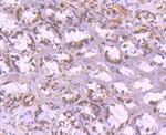 YY1 Antibody in Immunohistochemistry (Paraffin) (IHC (P))