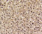 Phospho-Smad5 (Ser463,Ser465) Antibody in Immunohistochemistry (Paraffin) (IHC (P))