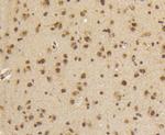 Phospho-Smad5 (Ser463,Ser465) Antibody in Immunohistochemistry (Paraffin) (IHC (P))