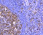 CDK1 Antibody in Immunohistochemistry (Paraffin) (IHC (P))