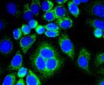 Calponin 1 Antibody in Immunocytochemistry (ICC/IF)