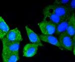 ATM Antibody in Immunocytochemistry (ICC/IF)