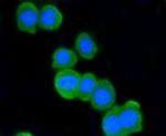 ATM Antibody in Immunocytochemistry (ICC/IF)