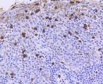 ATM Antibody in Immunohistochemistry (Paraffin) (IHC (P))