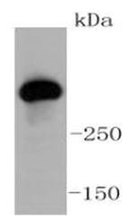 ATM Antibody in Western Blot (WB)