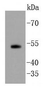 SMAD5 Antibody in Western Blot (WB)