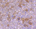 NGF Antibody in Immunohistochemistry (Paraffin) (IHC (P))