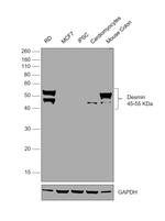 Desmin Antibody in Western Blot (WB)