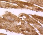 Desmin Antibody in Immunohistochemistry (Paraffin) (IHC (P))