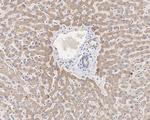 PIK3CA Antibody in Immunohistochemistry (Paraffin) (IHC (P))