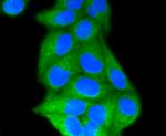 LDLR Antibody in Immunocytochemistry (ICC/IF)