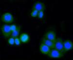 MMP14 Antibody in Immunocytochemistry (ICC/IF)