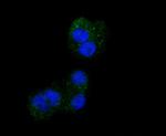 CD61 (Integrin beta 3) Antibody in Immunocytochemistry (ICC/IF)