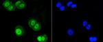 SUMO1 Antibody in Immunocytochemistry (ICC/IF)