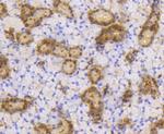 SUMO1 Antibody in Immunohistochemistry (Paraffin) (IHC (P))