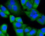 NOTCH1 Antibody in Immunocytochemistry (ICC/IF)