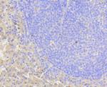 NOTCH1 Antibody in Immunohistochemistry (Paraffin) (IHC (P))