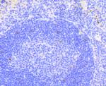 NOTCH1 Antibody in Immunohistochemistry (Paraffin) (IHC (P))