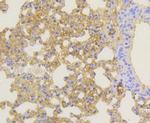 NOTCH1 Antibody in Immunohistochemistry (Paraffin) (IHC (P))